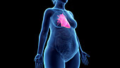 Obese woman's heart, illustration