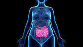 Obese woman's small intestine, illustration