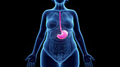 Obese woman's stomach, illustration