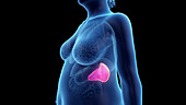 Obese woman's spleen, illustration