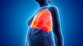 Obese woman's lung, illustration
