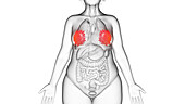 Obese woman's mammary glands, illustration