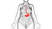 Obese woman's stomach, illustration