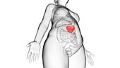 Obese woman's spleen, illustration