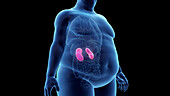 Obese man's kidneys, illustration