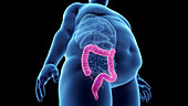 Obese man's colon, illustration