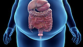 Obese man's abdominal organs, illustration