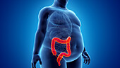 Obese man's colon, illustration