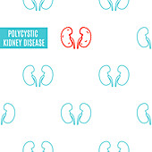 Polycystic kidney disease, conceptual illustration