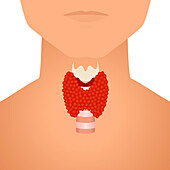 Thyroid in men, conceptual illustration