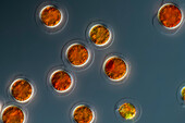 Haematococcus sp, algae, light micrograph