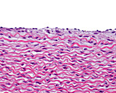 Elastic lamellae in human aorta, light micrograph
