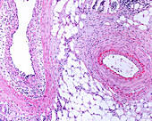 Muscular artery and vein, light micrograph