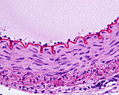 Muscular artery wall, light micrograph