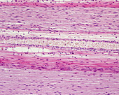 Arteriole in nerve fibres, light micrograph