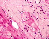 Purkinje fibres in the heart, light micrograph