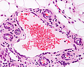 Rete mirabile blood vessels, light micrograph