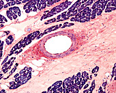 Coronary artery, light micrograph
