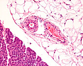 Arteriole and venule, light micrograph