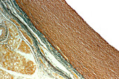 Elastic artery, light micrograph