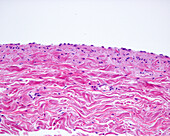 Large vein wall, light micrograph