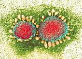 Covid-19 coronavirus, TEM