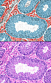 Testicle Leydig cells, light micrographs