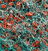 Red blood cells and platelets in blood clot, SEM