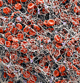 Red blood cells and platelets in blood clot, SEM