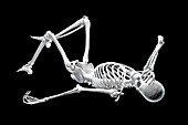 Human skeleton in pain, conceptual illustration