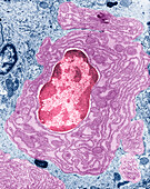 Intestinal cell, TEM