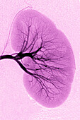 Left renal artery, angiography