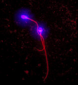 Human sperm, light micrograph immunocytochemistry