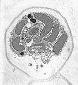 Cell organelles, TEM