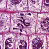 Metaphase in onion root tip cell, light micrograph