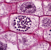 Prophase in onion root tip cell, light micrograph