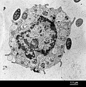 Mast cell (mouse) ingesting e coli, TEM