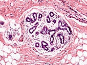 Inactive human mammary gland, light micrograph