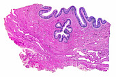 Human urethra, light micrograph