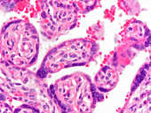 Human placenta, light micrograph