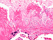 Human placenta, light micrograph