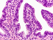 Human oviduct, light micrograph