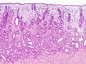 Human uterus, light micrograph