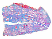 Human Bartholin's gland, light micrograph