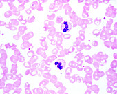 Human blood smear with neutrophils, light micrograph