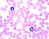 Human blood smear with band neutrophils, light micrograph