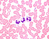 Leukocytosis, light micrograph