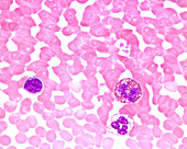 Human blood smear with leukocytes, light micrograph