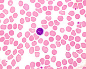 Human blood smear with lymphocyte, light micrograph