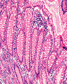 Mucosal crypts in human colon, light micrograph